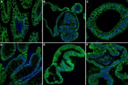 Anti-Epithelial Cell Adhesion Molecule (EpCAM) Antibody, clone 8 clone mab 8, from mouse