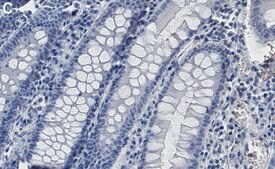 Anti-γ Catenin Antibody, clone 1H22 ZooMAb® Rabbit Monoclonal recombinant, expressed in HEK 293 cells