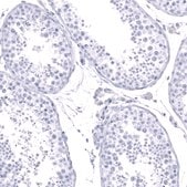 Monoclonal Anti-CALB1 antibody produced in mouse Prestige Antibodies® Powered by Atlas Antibodies, clone CL15059, purified antibody (Protein A)