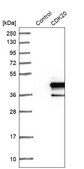 Anti-CDK20 antibody produced in rabbit Prestige Antibodies® Powered by Atlas Antibodies, affinity isolated antibody, buffered aqueous glycerol solution, ab1