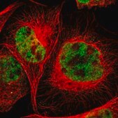 Anti-RGAG4 antibody produced in rabbit Prestige Antibodies&#174; Powered by Atlas Antibodies, affinity isolated antibody, buffered aqueous glycerol solution