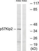 Anti-p57 KIP2 antibody produced in rabbit affinity isolated antibody