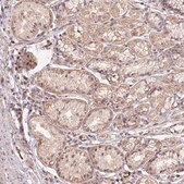Anti-MMACHC antibody produced in rabbit Prestige Antibodies&#174; Powered by Atlas Antibodies, affinity isolated antibody, buffered aqueous glycerol solution, ab1