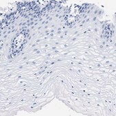 Anti-CLEC4G antibody produced in rabbit Prestige Antibodies&#174; Powered by Atlas Antibodies, affinity isolated antibody, buffered aqueous glycerol solution