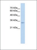 Anti-THOC4 antibody produced in rabbit IgG fraction of antiserum
