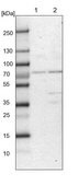Anti-CLCN3 antibody produced in rabbit Prestige Antibodies&#174; Powered by Atlas Antibodies, affinity isolated antibody, buffered aqueous glycerol solution