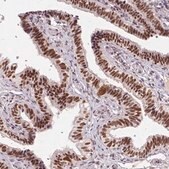 Anti-CD2BP2 antibody produced in rabbit Prestige Antibodies&#174; Powered by Atlas Antibodies, affinity isolated antibody, buffered aqueous glycerol solution