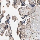 抗-SVBP 兔抗 Prestige Antibodies&#174; Powered by Atlas Antibodies, affinity isolated antibody, buffered aqueous glycerol solution