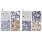 Anti-MURC antibody produced in rabbit Prestige Antibodies® Powered by Atlas Antibodies, affinity isolated antibody, buffered aqueous glycerol solution, Ab1