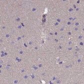 Anti-AMDHD2 antibody produced in rabbit Prestige Antibodies&#174; Powered by Atlas Antibodies, affinity isolated antibody, buffered aqueous glycerol solution