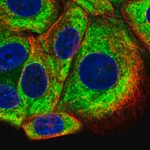 Anti-RPS10 antibody produced in rabbit Prestige Antibodies&#174; Powered by Atlas Antibodies, affinity isolated antibody, buffered aqueous glycerol solution