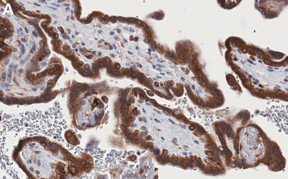 Anti-ACSL3 Antibody, clone 1I18 ZooMAb&#174; Rabbit Monoclonal recombinant, expressed in HEK 293 cells