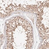 Anti-KCMF1 antibody produced in rabbit Prestige Antibodies® Powered by Atlas Antibodies, affinity isolated antibody, buffered aqueous glycerol solution, ab1