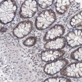 Anti-PSMB2 antibody produced in rabbit Prestige Antibodies&#174; Powered by Atlas Antibodies, affinity isolated antibody, buffered aqueous glycerol solution, Ab2