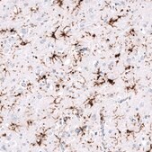Monoclonal Anti-HLA-DRA antibody produced in mouse Prestige Antibodies® Powered by Atlas Antibodies, clone CL10962, purified antibody (Protein A)
