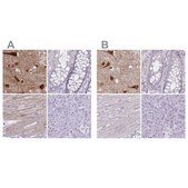 Anti-HOMER1 antibody produced in rabbit Prestige Antibodies® Powered by Atlas Antibodies, affinity isolated antibody, buffered aqueous glycerol solution