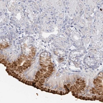 Anti-RAB33B antibody produced in rabbit Prestige Antibodies&#174; Powered by Atlas Antibodies, affinity isolated antibody, buffered aqueous glycerol solution