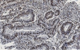 Anti-Phospho-IRF-3-(Ser396) Antibody, clone 2M20 ZooMAb® Rabbit Monoclonal recombinant, expressed in HEK 293 cells