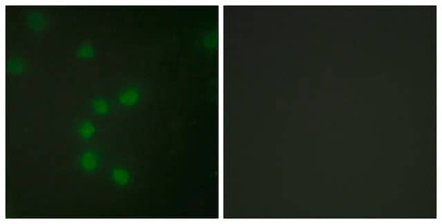 Anti-Telomerase antibody produced in rabbit affinity isolated antibody