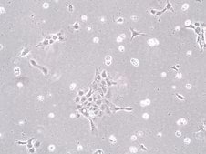 MLM.3 Mouse Lung Metastasis Cell Line