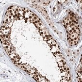 Anti-ZNF470 antibody produced in rabbit Prestige Antibodies® Powered by Atlas Antibodies, affinity isolated antibody, buffered aqueous glycerol solution