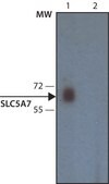 Monoclonal Anti-SLC5A7 antibody produced in mouse ~1.0 mg/mL, clone 62-2E8, purified immunoglobulin