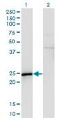 Monoclonal Anti-SPA17 antibody produced in mouse clone 3B6, purified immunoglobulin, buffered aqueous solution