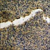 Anti-phospho-Akt (pTyr474) antibody produced in rabbit affinity isolated antibody