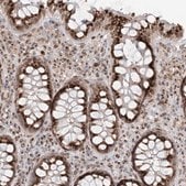 Anti-SLC35A2 antibody produced in rabbit Prestige Antibodies&#174; Powered by Atlas Antibodies, affinity isolated antibody, buffered aqueous glycerol solution