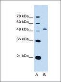 Anti-PAX8 antibody produced in rabbit affinity isolated antibody