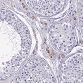 Anti-OAT antibody produced in rabbit Prestige Antibodies&#174; Powered by Atlas Antibodies, affinity isolated antibody, buffered aqueous glycerol solution