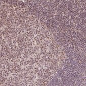 Anti-PLK1 antibody produced in rabbit Prestige Antibodies® Powered by Atlas Antibodies, affinity isolated antibody, buffered aqueous glycerol solution