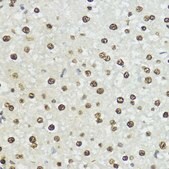 Anti-Phospho-Histone H3-S10/T11 antibody produced in rabbit