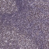 Anti-CCNK Prestige Antibodies® Powered by Atlas Antibodies, affinity isolated antibody
