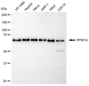 KD-Validated Anti PPM1G Antibody, clone 23GB2585, Rabbit Monoclonal clone 23GB2585, recombinant rabbit monoclonal, expressed in HEK293 cells