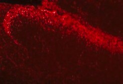 Anti-Calcium Channel Antibody, Voltage Gated &#945; 1A Chemicon&#174;, from rabbit