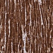 Anti-C14orf2 antibody produced in rabbit Prestige Antibodies&#174; Powered by Atlas Antibodies, affinity isolated antibody, buffered aqueous glycerol solution