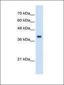Anti-IFI44L IgG fraction of antiserum