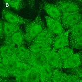 Anti-STAT1 (alpha &amp; beta) clone 3G14 ZooMAb® Rabbit Monoclonal recombinant, expressed in HEK 293 cells