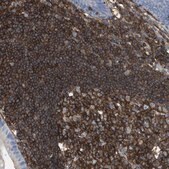 Anti-PASK antibody produced in rabbit Prestige Antibodies&#174; Powered by Atlas Antibodies, affinity isolated antibody, buffered aqueous glycerol solution