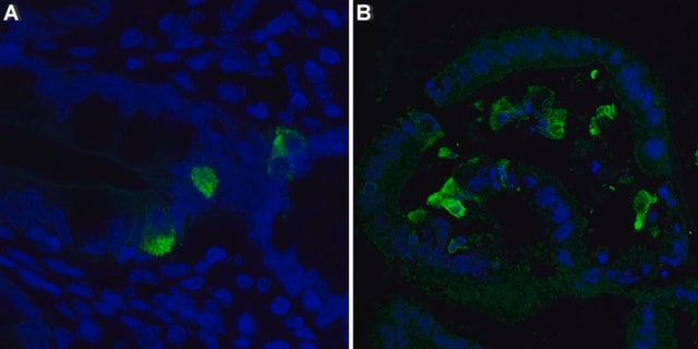 Anti-Chromogranin A Antibody, clone 5F23 ZooMAb® Rabbit Monoclonal recombinant, expressed in HEK 293 cells