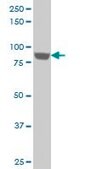 Monoclonal Anti-UBTF antibody produced in mouse clone 6C6, purified immunoglobulin, buffered aqueous solution
