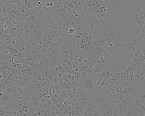 PANC-1 Cell Line human NOTE: Both the cell line and DNA from the cell line may be available for this product. Please choose -1VL or VIAL for cells, or -DNA-5UG for DNA, 87092802, human pancreas, Epithelial
