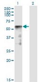 Monoclonal Anti-SESN2 antibody produced in mouse clone 1A12, purified immunoglobulin, buffered aqueous solution