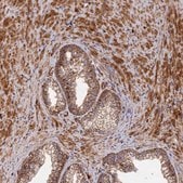 Anti-DSTYK antibody produced in rabbit Prestige Antibodies&#174; Powered by Atlas Antibodies, affinity isolated antibody, buffered aqueous glycerol solution