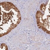 Anti-SFT2D2 antibody produced in rabbit Prestige Antibodies&#174; Powered by Atlas Antibodies, affinity isolated antibody, buffered aqueous glycerol solution