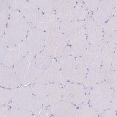 Anti-TBC1D10B antibody produced in rabbit Prestige Antibodies&#174; Powered by Atlas Antibodies, affinity isolated antibody, buffered aqueous glycerol solution
