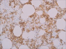 Spectrin (EP251) Rabbit Monoclonal Primary Antibody
