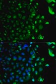 Anti-RAB5A antibody produced in rabbit