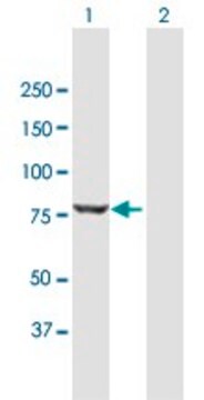 Anti-DKFZP434G1415 antibody produced in mouse purified immunoglobulin, buffered aqueous solution